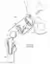 Fig. 02 - ELECTROSURGICAL SYSTEM AND METHOD FOR TREATING HARD BODY TISSUE