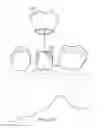 Fig. 07 - ELECTROSURGICAL SYSTEM AND METHOD FOR TREATING HARD BODY TISSUE