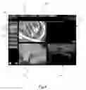 Fig. 04 - Apparatus and method for performing diagnostic imaging examinations with tutorial means for the user, both in the preparatory step and in the operative step