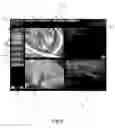Fig. 05 - Apparatus and method for performing diagnostic imaging examinations with tutorial means for the user, both in the preparatory step and in the operative step