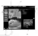 Fig. 06 - Apparatus and method for performing diagnostic imaging examinations with tutorial means for the user, both in the preparatory step and in the operative step