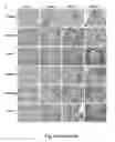Fig. 09 - Tmsb4 as a Biomarker for IgA Nephropathy