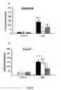 Fig. 22 - Tmsb4 as a Biomarker for IgA Nephropathy