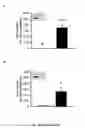 Fig. 28 - Tmsb4 as a Biomarker for IgA Nephropathy
