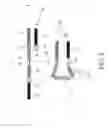 Fig. 08 - SEQUENCE AMPLIFICATION WITH LINEAR PRIMERS
