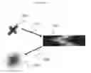 Fig. 32 - Optical projection tomography microscopy (OPTM) for large specimen sizes