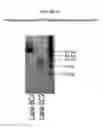 Fig. 09 - Polymerization of nucleic acids using activation by polyphosphorolysis (APP) reactions