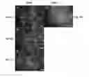 Fig. 09 - Double coating procedure for the membranes of bioartificial kidneys
