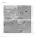 Fig. 18 - NOVEL LACTOBACILLUS PLANTARUM AND COMPOSITION COMPRISING SAME