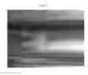 Fig. 09 - DEVICE FOR REMOVING CUMULUS FROM OOCYTES