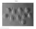 Fig. 10 - DEVICE FOR REMOVING CUMULUS FROM OOCYTES