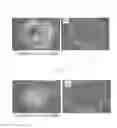 Fig. 04 - Method of producing induced pluripotent stem cells using inhibitors of P53