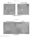 Fig. 20 - Method of producing induced pluripotent stem cells using inhibitors of P53