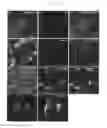Fig. 30 - Method of producing induced pluripotent stem cells using inhibitors of P53