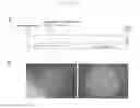 Fig. 31 - Method of producing induced pluripotent stem cells using inhibitors of P53