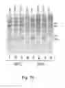 Fig. 52 - Multi plasmids system for the production of influenza virus