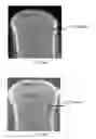 Fig. 33 - Method to increase tensile stress of silicon nitride films using a post PECVD deposition UV cure