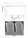 Fig. 35 - Method to increase tensile stress of silicon nitride films using a post PECVD deposition UV cure