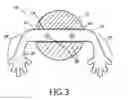 Fig. 04 - Toy having hard molded body with soft elastomeric appendages and its associated method of manufacture