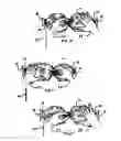 Fig. 06 - Complete deer calling system