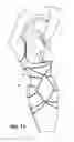 Fig. 11 - Garment for providing body shaping
