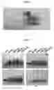 Fig. 02 - Anticoagulant and composition for preventing thrombus containing poly-gamma-glutamic acid