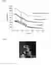 Fig. 02 - STABILIZATION OF AMORPHOUS DRUGS USING SPONGE-LIKE CARRIER MATRICES