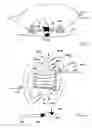 Fig. 05 - Guided ablation devices, systems, and methods
