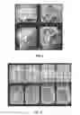 Fig. 08 - SYSTEM AND METHODS FOR AUTOMATIC PLACEMENT OF SPATIAL SUPRESSION REGIONS IN MRI AND MRSI