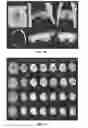 Fig. 09 - SYSTEM AND METHODS FOR AUTOMATIC PLACEMENT OF SPATIAL SUPRESSION REGIONS IN MRI AND MRSI