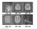Fig. 10 - SYSTEM AND METHODS FOR AUTOMATIC PLACEMENT OF SPATIAL SUPRESSION REGIONS IN MRI AND MRSI