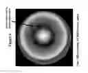 Fig. 07 - THERMOACOUSTIC SYSTEM FOR ANALYZING TISSUE