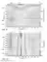 Fig. 08 - Systems and Methods for Determining Global Circumferential Strain in Cardiology