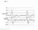 Fig. 05 - Pulse wave detection device and pulse wave detection method