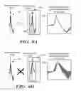 Fig. 06 - Methods and devices for accurately classifying cardiac activity