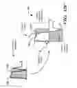 Fig. 15 - Methods and devices for accurately classifying cardiac activity