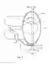 Fig. 03 - Hip orthosis, method for preventing the dislocation of a hip and use of a hip orthosis