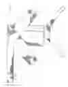 Fig. 03 - Knee brace