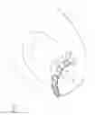 Fig. 02 - Nail correcting device and medical set for nail correction