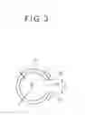 Fig. 04 - Nail correcting device and medical set for nail correction