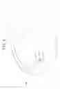 Fig. 09 - Nail correcting device and medical set for nail correction