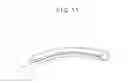 Fig. 12 - Nail correcting device and medical set for nail correction