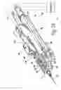 Fig. 11 - METHODS, SYSTEMS AND APPARATUS FOR RELIEVING PRESSURE IN AN ORGAN