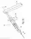 Fig. 15 - METHODS, SYSTEMS AND APPARATUS FOR RELIEVING PRESSURE IN AN ORGAN