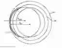 Fig. 01 - Intraocular implants and methods and kits therefor