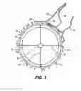 Fig. 04 - Intraocular implants and methods and kits therefor