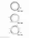 Fig. 11 - Intraocular implants and methods and kits therefor