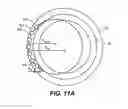 Fig. 12 - Intraocular implants and methods and kits therefor
