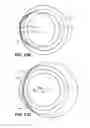 Fig. 13 - Intraocular implants and methods and kits therefor