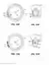 Fig. 15 - Intraocular implants and methods and kits therefor